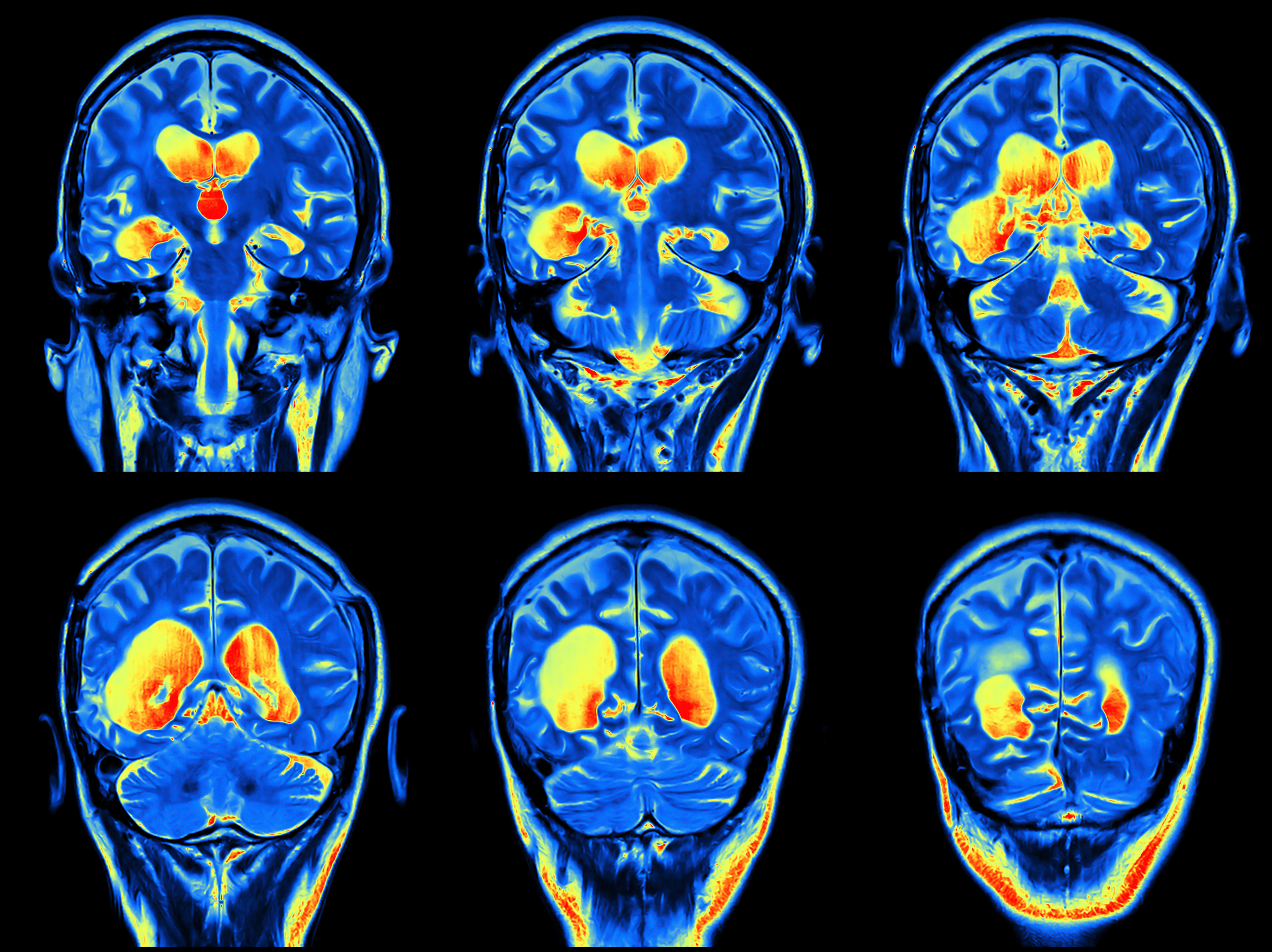 Долголетие мрт. Снимки головного мозга. Томография головного мозга. Мрт головного мозга с контрастом. Кт головного мозга с контрастом.